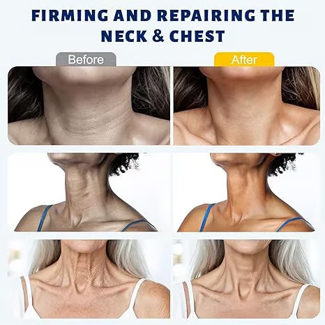 Visibly Firmer Neck in 7 Days — Collagen‑Boosting Neck Cream with Built‑In Roller