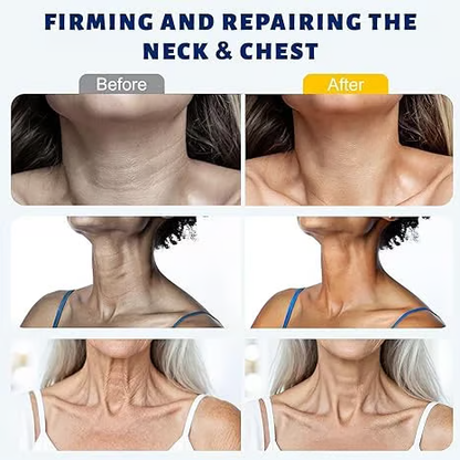 Visibly Firmer Neck in 7 Days — Collagen‑Boosting Neck Cream with Built‑In Roller