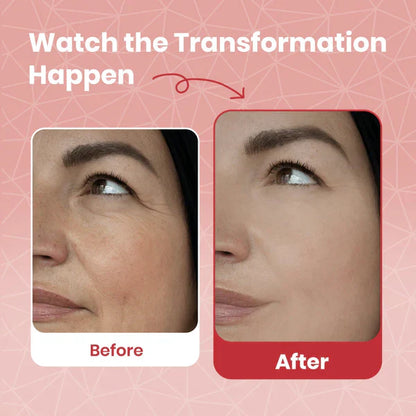 🔥 FLASH SALE: Buy 1 Get 1 FREE on Auvessara Time Reverse Cream! ⏳